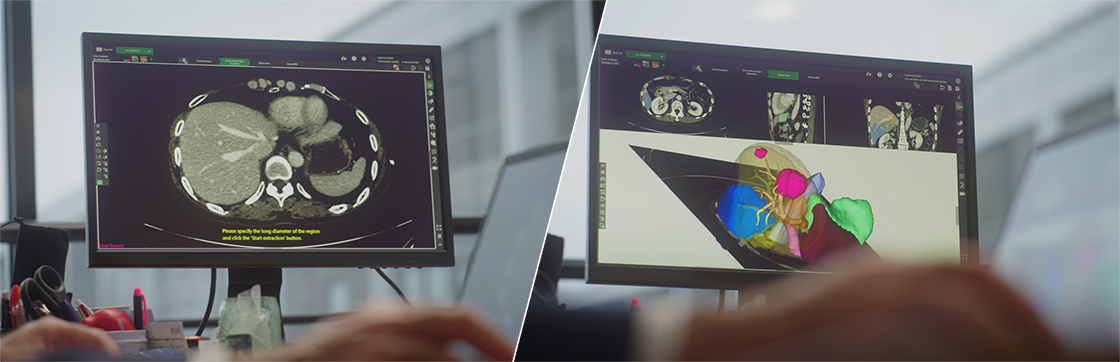 Monitor with CT image ／ Monitor with 3D CT image